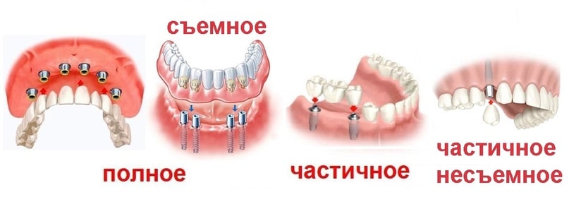 chem-otlichaetsya-massazh-ot-manualnoj-terapii-5
